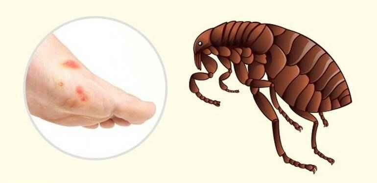 На фото показаны укусы блохи